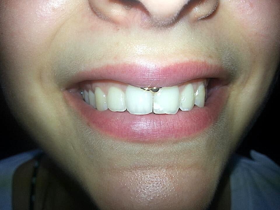 A beautiful Piercing done by sabrina, one of Anker Tattoo & Piercings professional artists